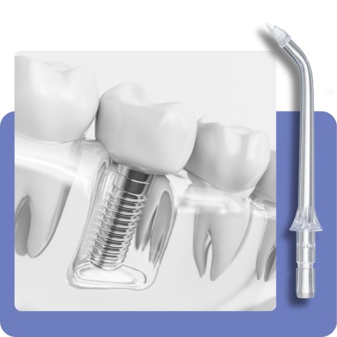 Irygator Dentystyczny Dentalforce 400Ml 5 Trybów 9,66 Bar 40 Dni Pracy