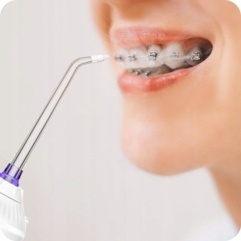 Irygator Do Zębów U-Smiler Ipx7 300Ml 5 Trybów, 5 Końcówek, Bezprzewodowy