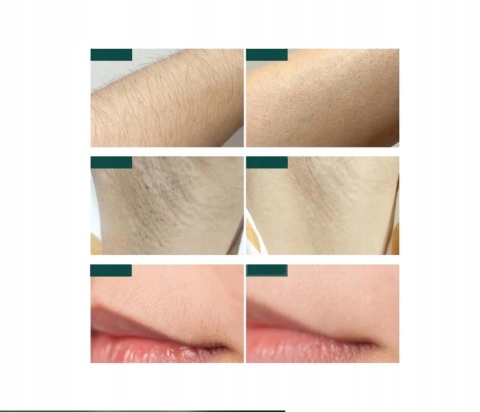 DEPILATOR IPL DO WŁOSÓW CIAŁA LASEROWY BIKINI NÓG DEPILACJA BEZBOLESNY