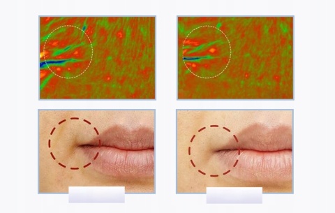 ULTRADŹWIĘKOWY Z TERAPIĄ ŚWIETLNĄ MASAŻER DO TWARZY ANLAN LIFTING SKÓRY