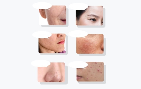 ULTRADŹWIĘKOWY Z TERAPIĄ ŚWIETLNĄ MASAŻER DO TWARZY ANLAN LIFTING SKÓRY